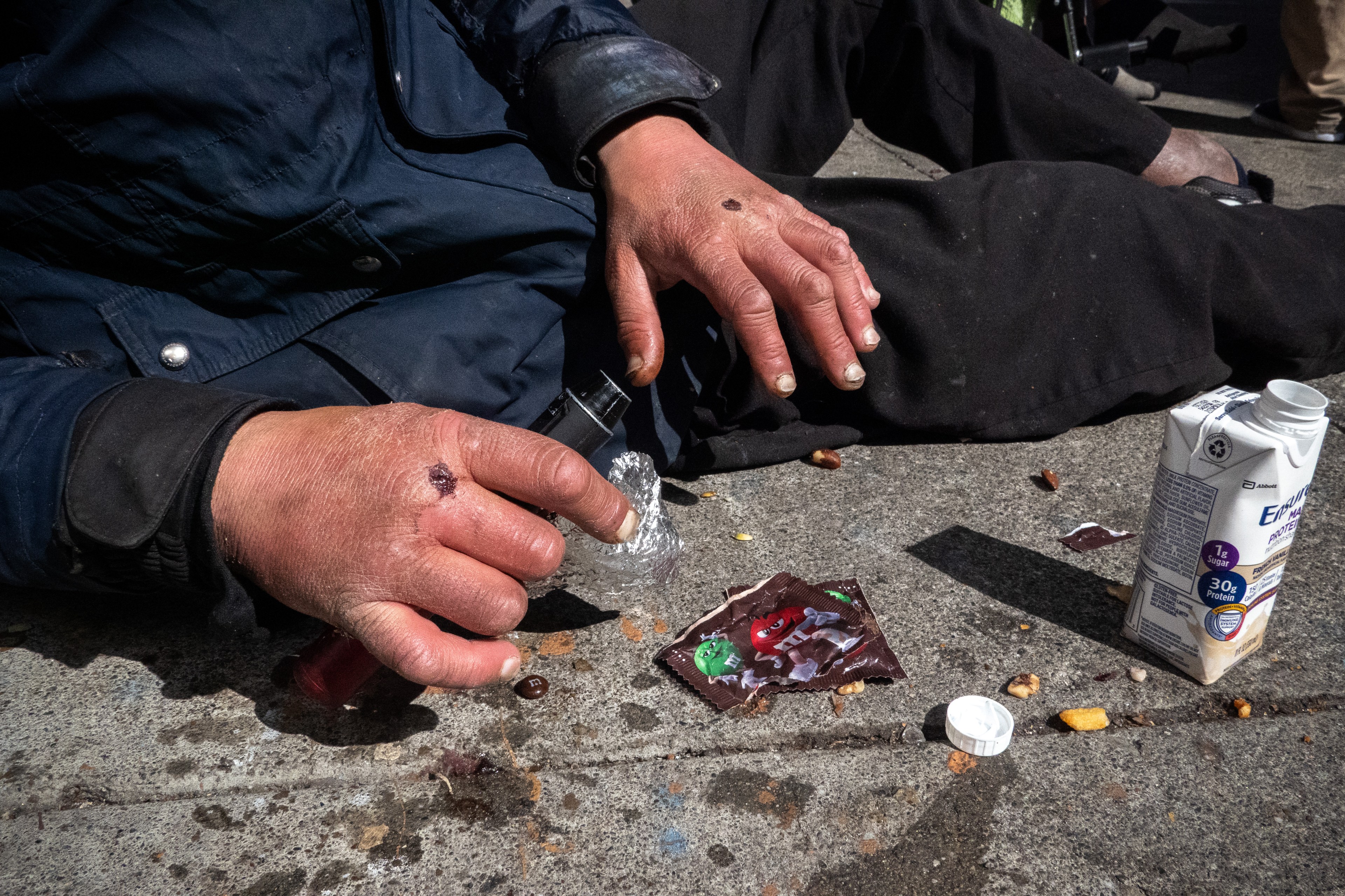 A person is lying on the ground, hands dirty with visible sores, near a spilled nutritional drink and a candy wrapper.