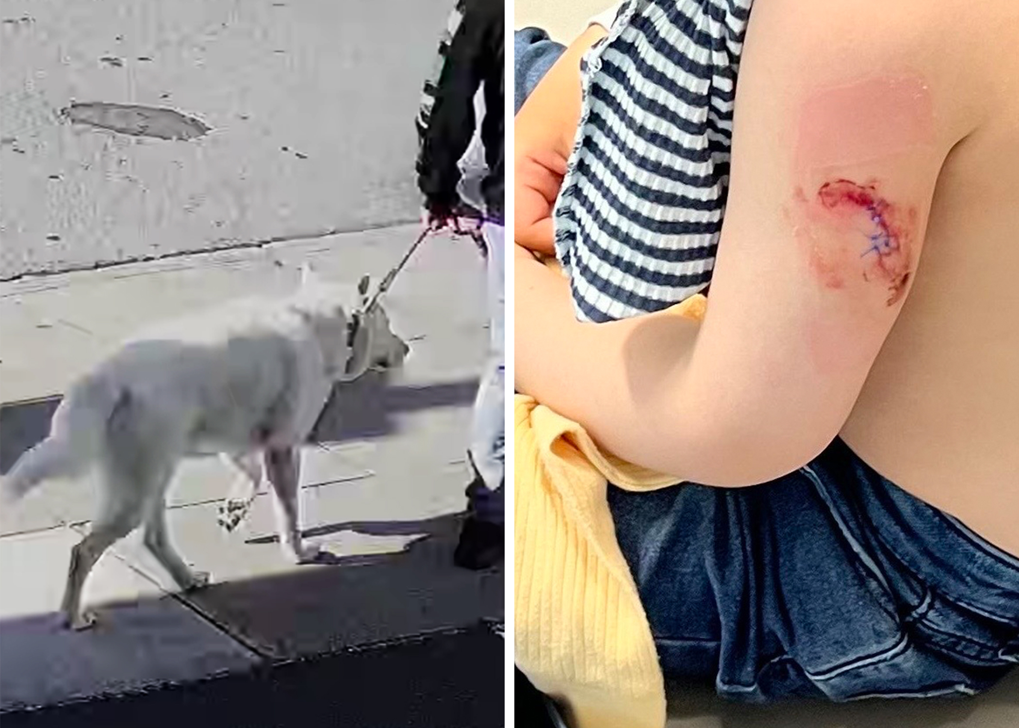 The image shows a white dog on a leash, and a close-up of an injured arm with a bandage and a wound with stitches.