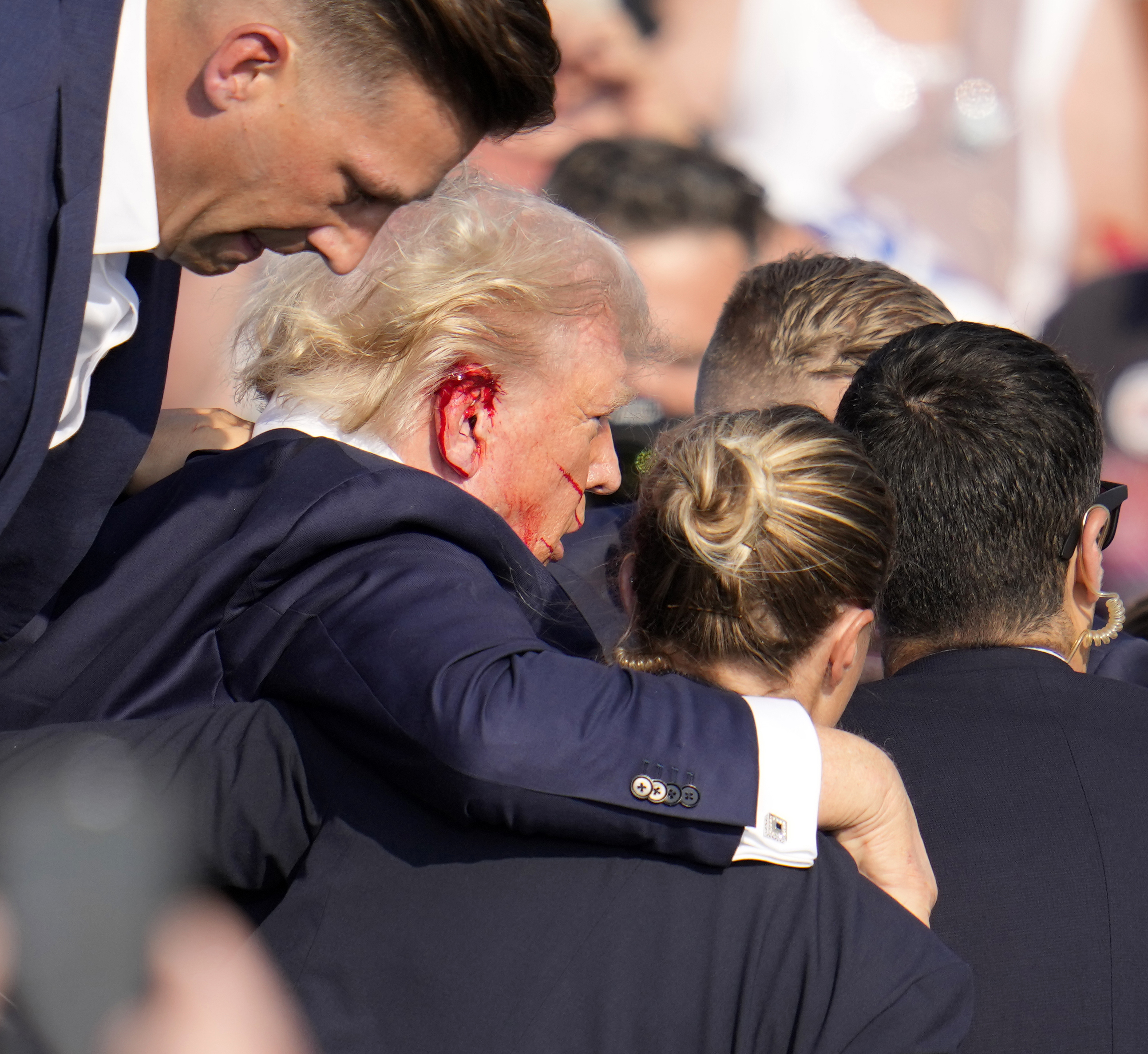 In a crowded setting, a man with blood on his face is supported by several people around him, who appear attentive and concerned for his well-being.