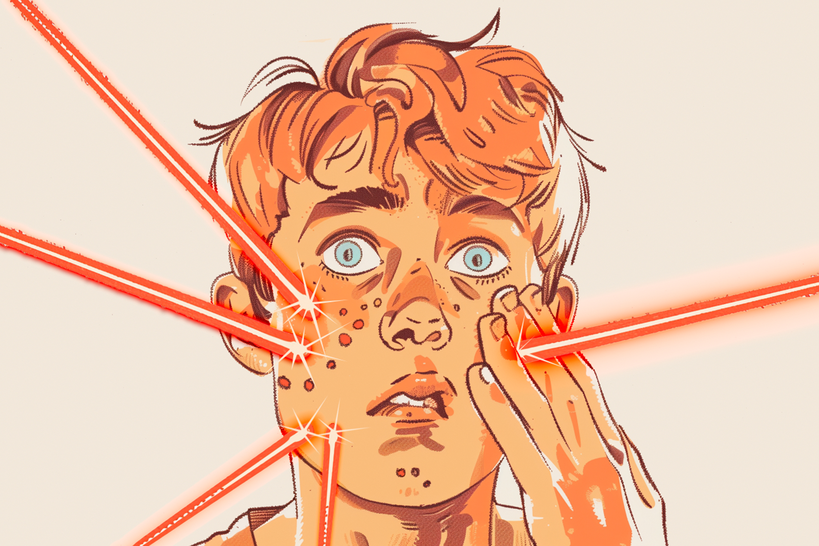 Illustration of kid getting laser treatment on face