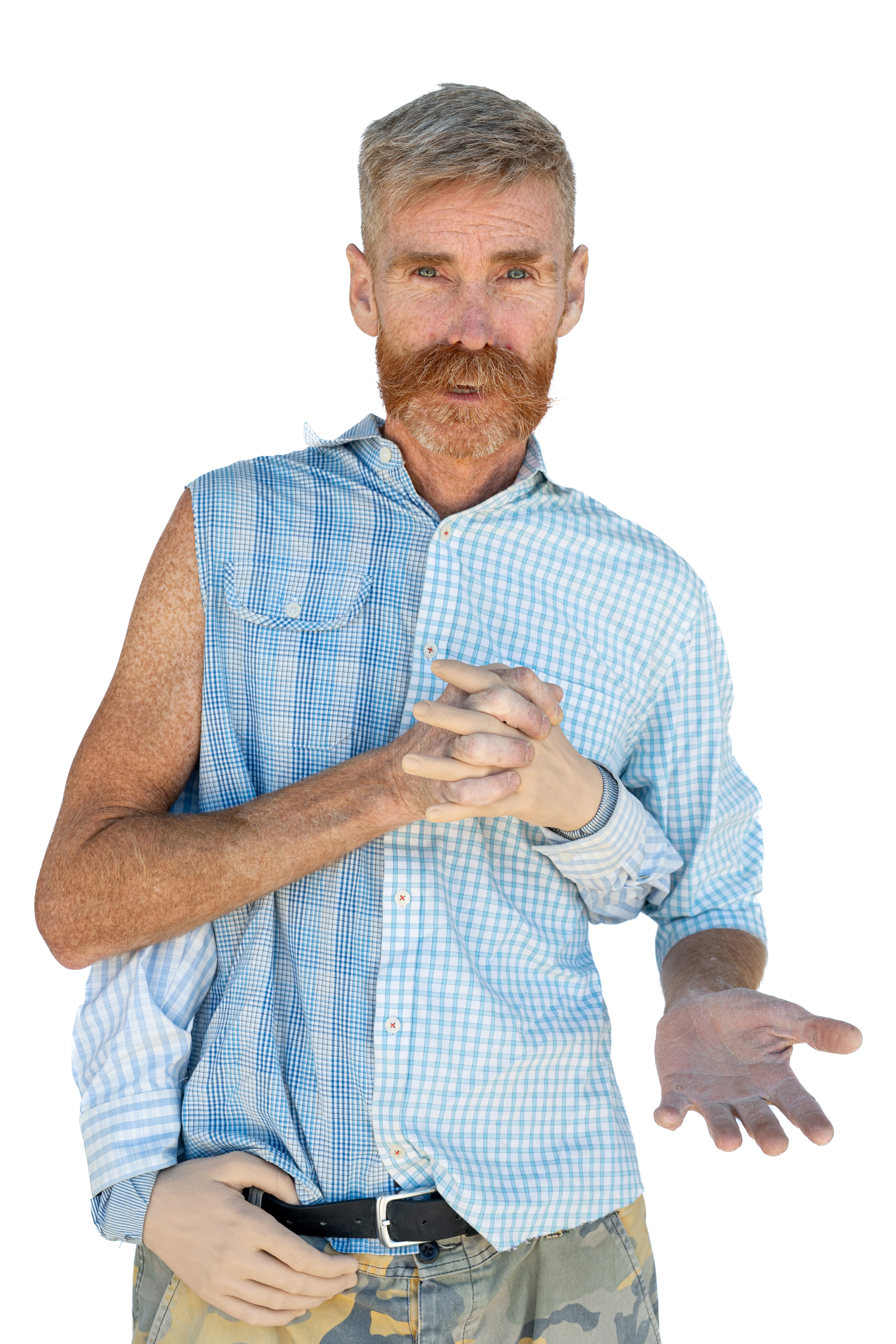 A man with a full beard and mustache, wearing a half-sleeved, split-patterned checkered shirt, holds multiple artificial hands, creating a surreal image.