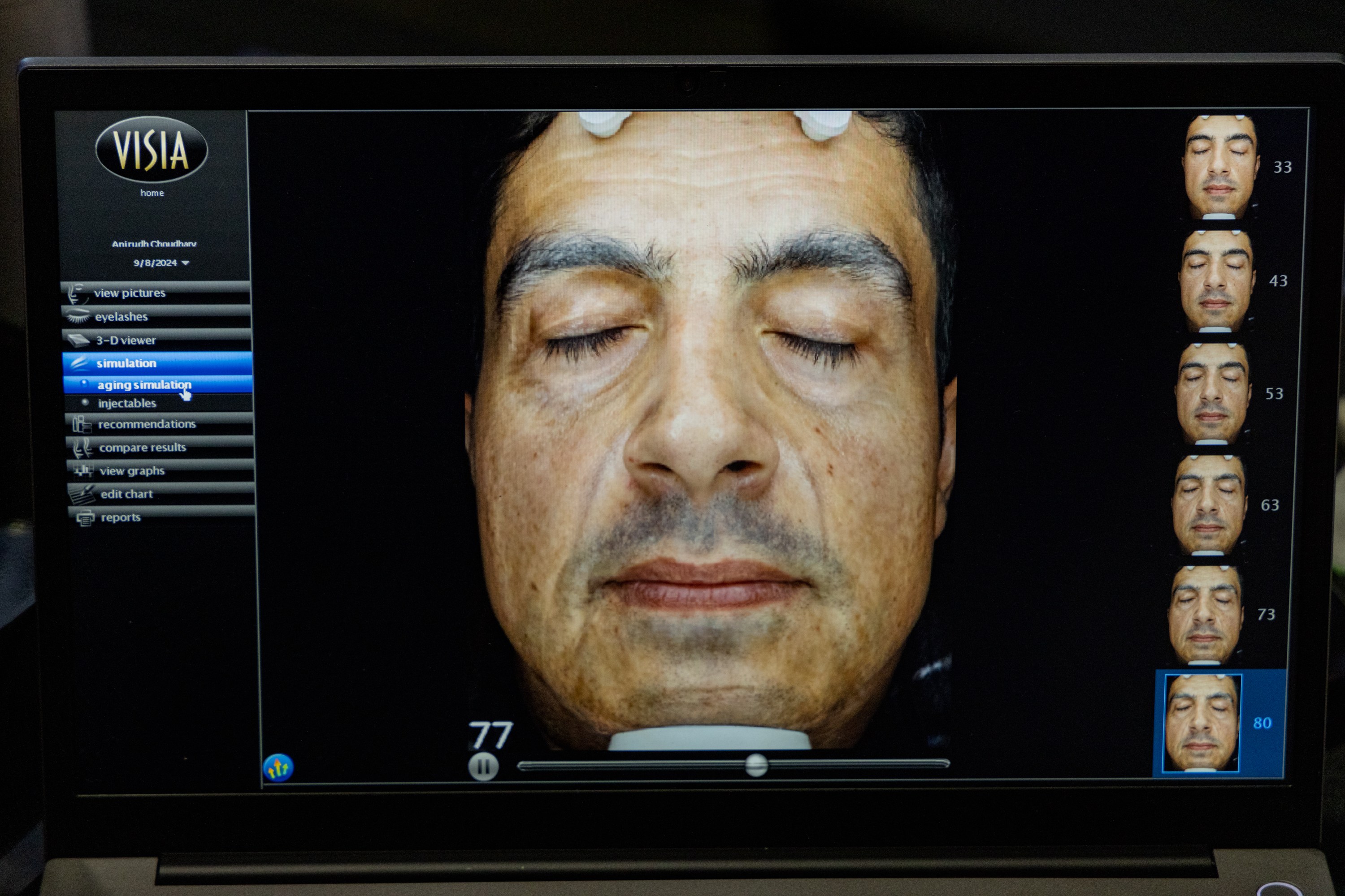 A computer screen displays a close-up image of a man's face with eyes closed. A menu on the left lists options like simulations and recommendations. Smaller age-progressed images are on the right.