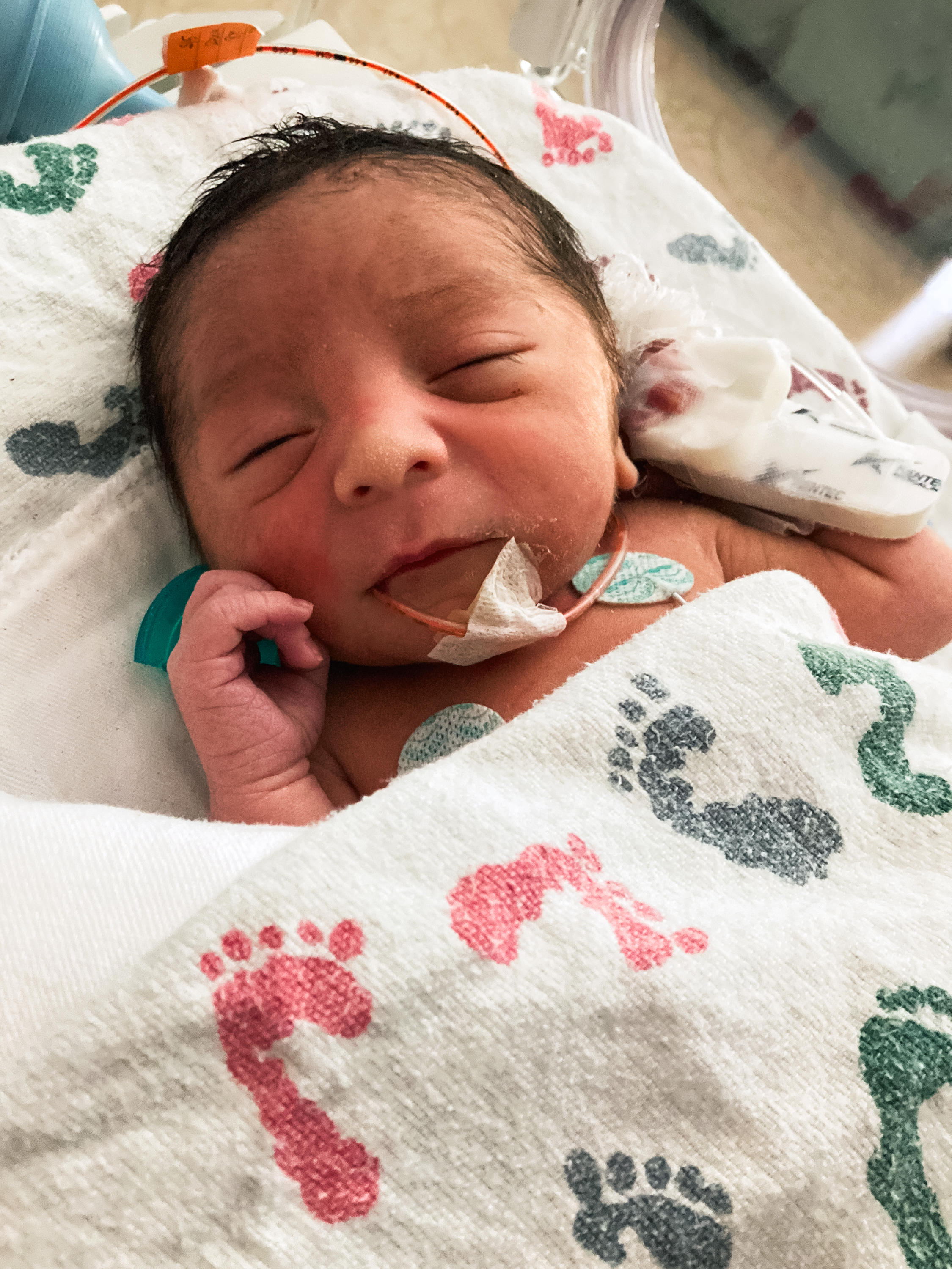 A newborn baby is peacefully sleeping, wrapped in a blanket with colorful footprints. They have monitoring devices on their chest and an oxygen tube.