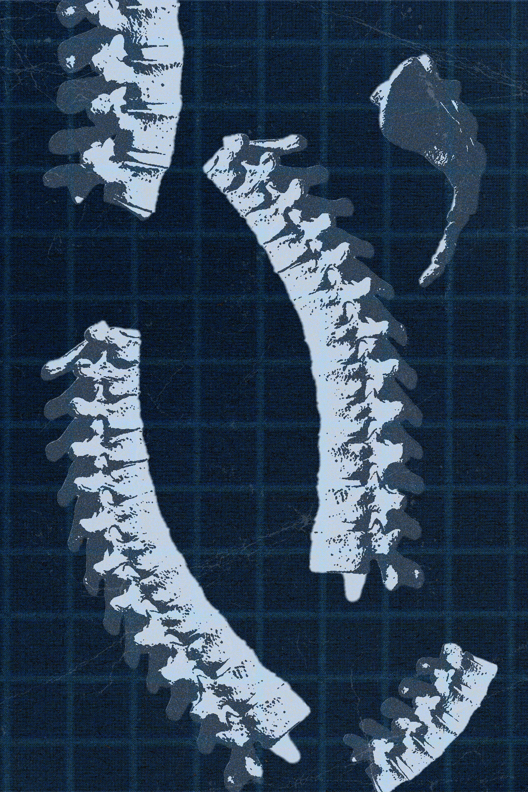A photo collage of bones.