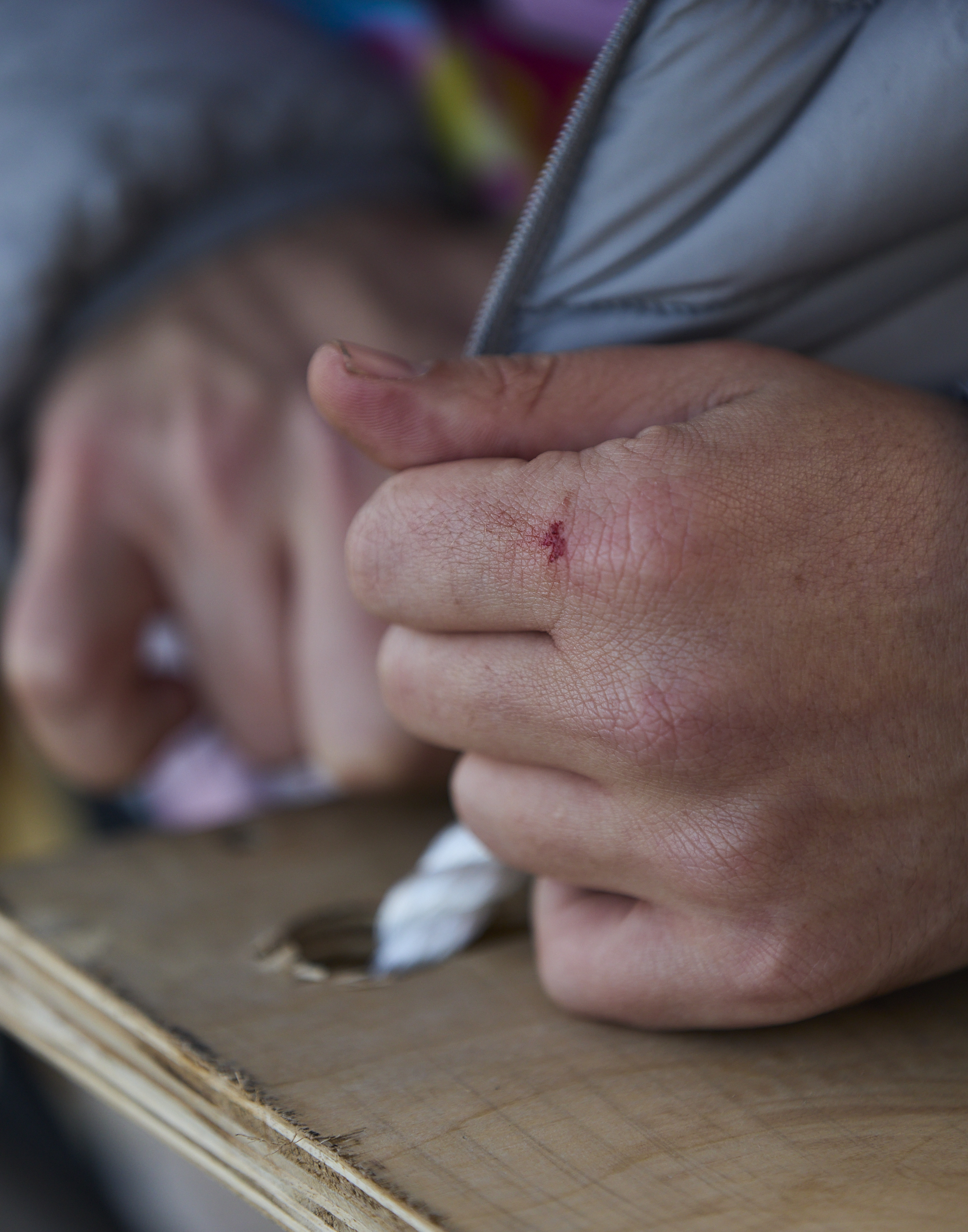 A close-up of hands gripping a rope through a hole in a wooden board, with a small cut and redness visible on the skin.