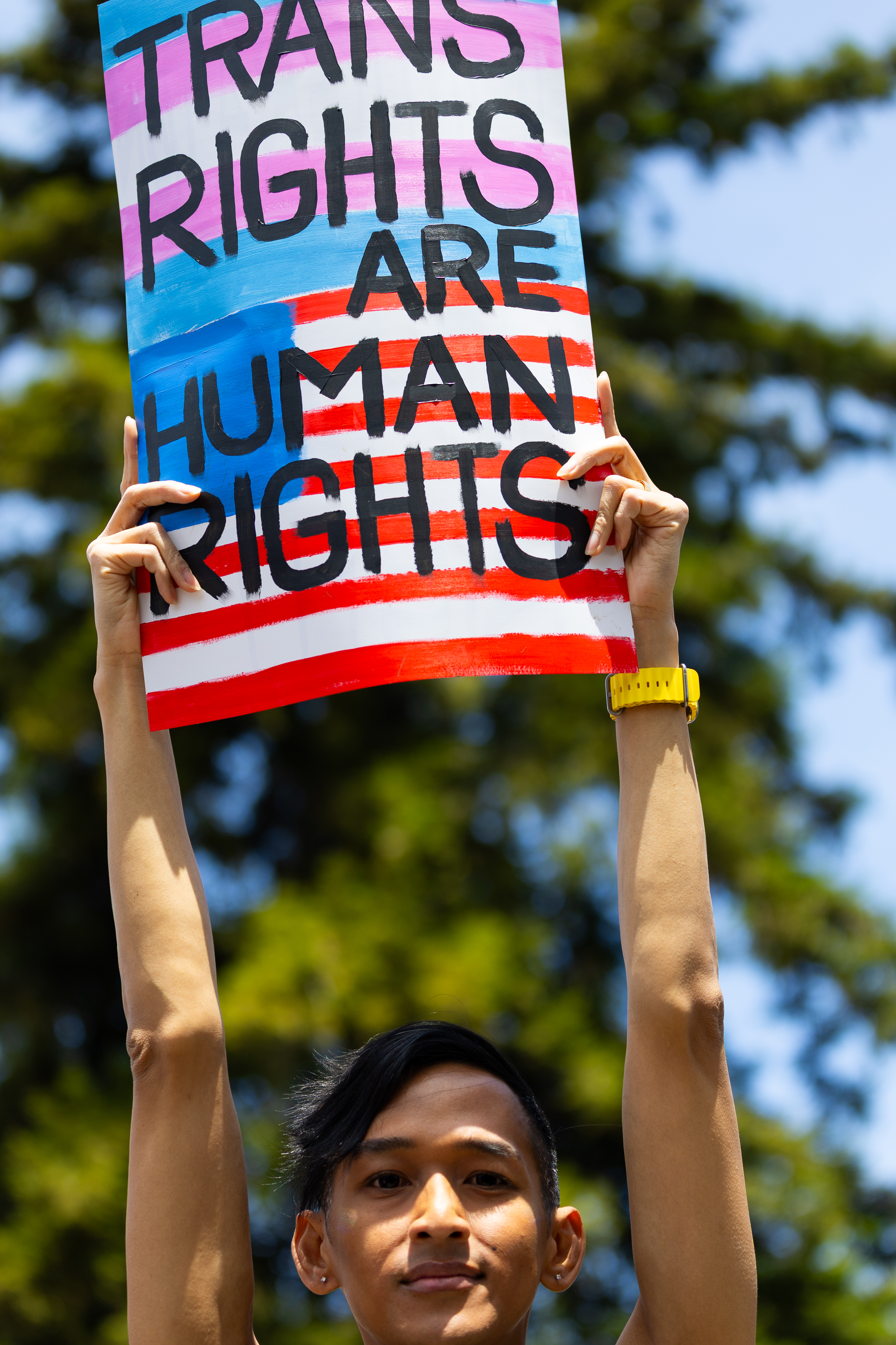 A person holds up a colorful sign reading &quot;Trans Rights Are Human Rights&quot; with a mix of blue, pink, red, and white stripes in a sunny outdoor setting.